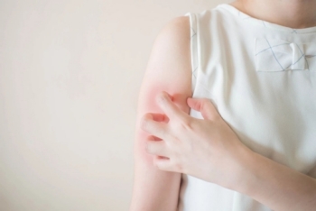 瘙痒红肿！乳腺癌放疗患者如何应对放射性皮炎？